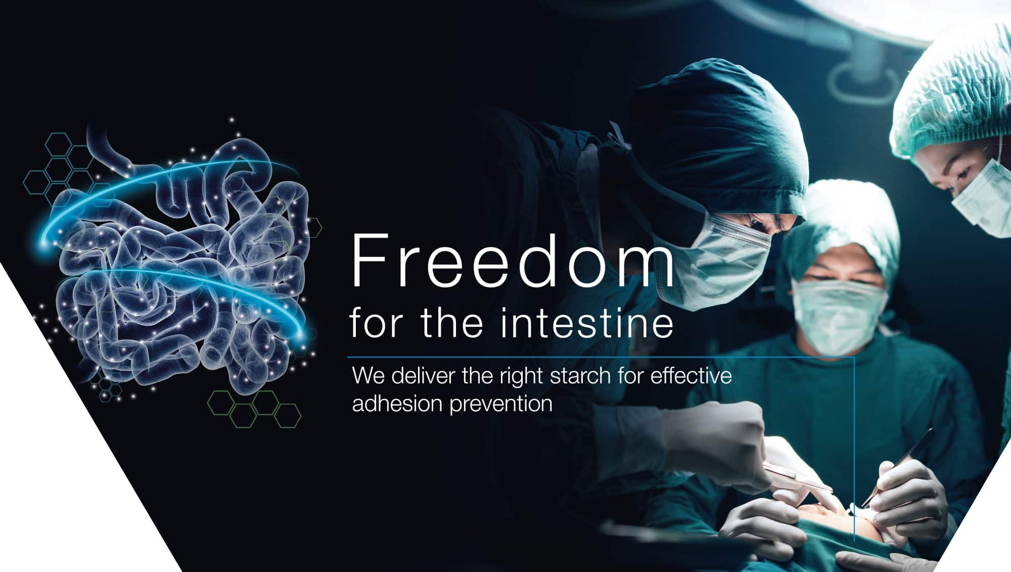 Adhesion prevention: Freedom for the intestine